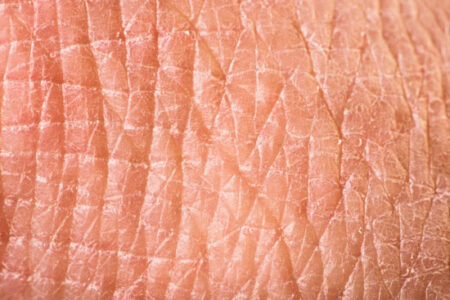 Under Your Skin Image